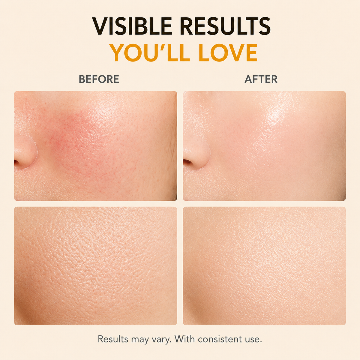 Auvelle Beauty Glow Pads — niacinamide, kojic acid & turmeric extract